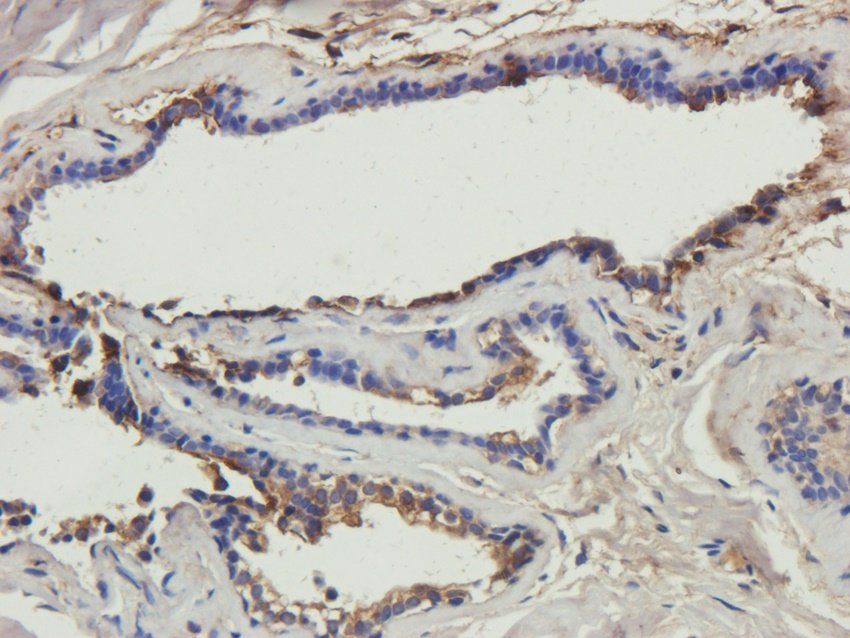 CTSS Rabbit Polyclonal Antibody