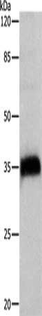 CTSZ Antibody