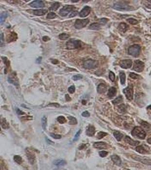 CUL1 Rabbit Polyclonal Antibody