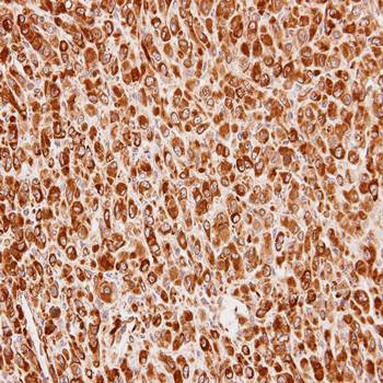 Cullin-7 antibody
