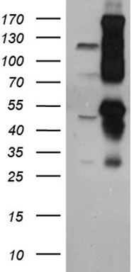 CUX1 Antibody