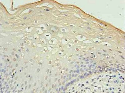 CXCR4 Antibody