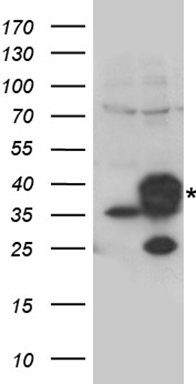 CYB5R3 Antibody