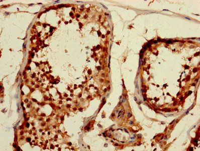 CDKN1A Antibody