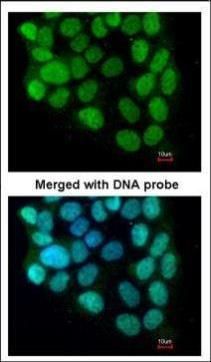 Cyclin T2 Rabbit Polyclonal Antibody