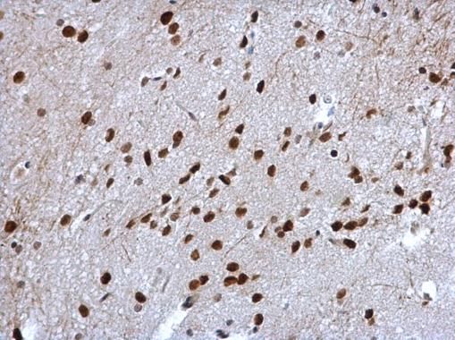 Cyclin T2 Rabbit Polyclonal Antibody