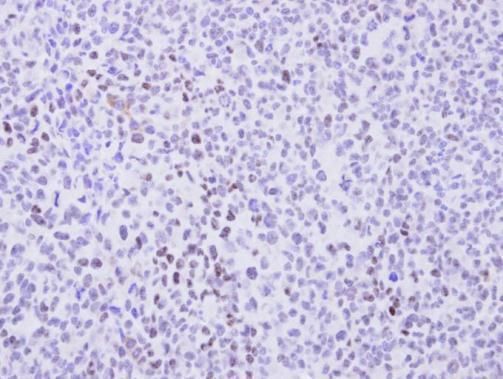 Cyclin T2 Rabbit Polyclonal Antibody