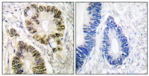 Cyclin E1 (Phospho-Thr395) Antibody