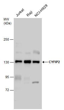 CYFIP2 antibody [N2C1], Internal