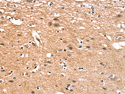 CYLD Antibody
