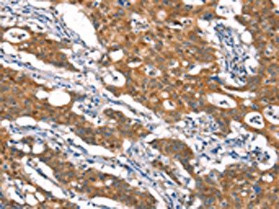 CYLD Antibody