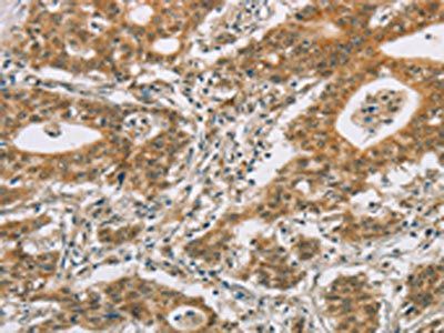 CYP11A1 Antibody