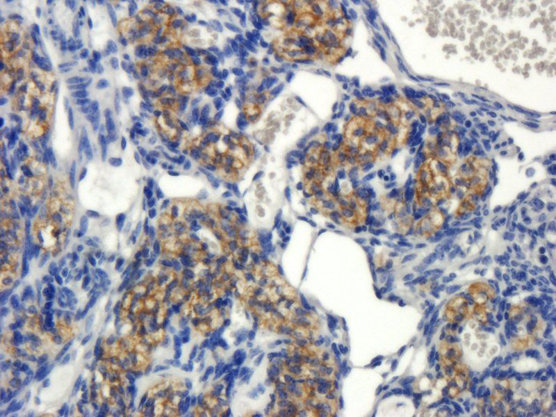 CYP11A1 Rabbit Polyclonal Antibody
