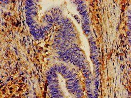 CYP1A1 Antibody