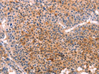 CYP1B1 Antibody
