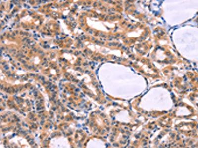 CYP1B1 Antibody
