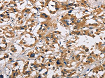 CYP21A2 Antibody