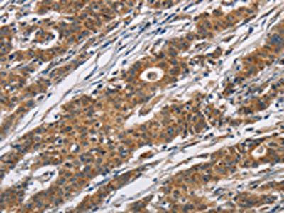 CYP21A2 Antibody