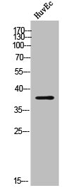 CYP24A1 Antibody