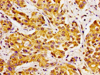 CYP27A1 Antibody