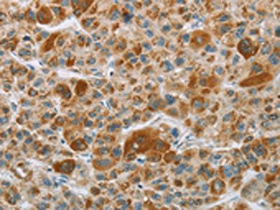 CYP27A1 Antibody
