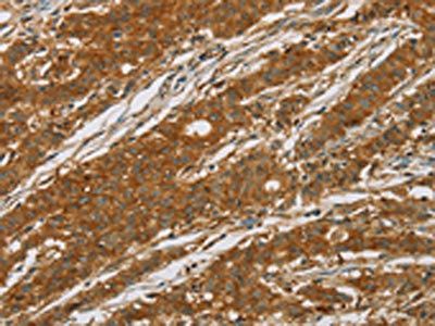 CYP27A1 Antibody