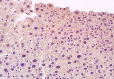 CYP27A1 Rabbit Polyclonal Antibody