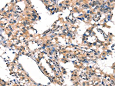 CYP2D6 Antibody