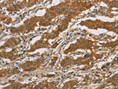 CYP39A1 Antibody
