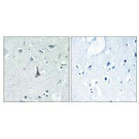 CYP3A4 Antibody