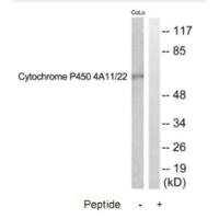 CYP4A11/CYP4A22 Antibody