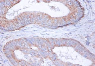 UQCRFS1 Antibody