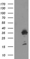 Cytochrome P450 2A6 Antibody
