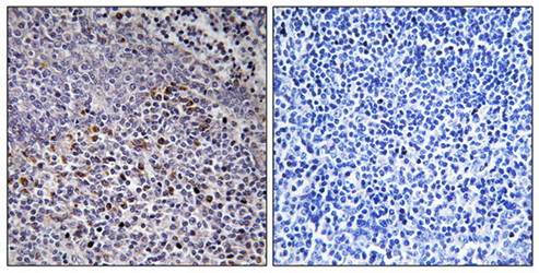 Cytochrome c-type Heme Lyase Antibody