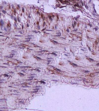 CYGB Rabbit Polyclonal Antibody