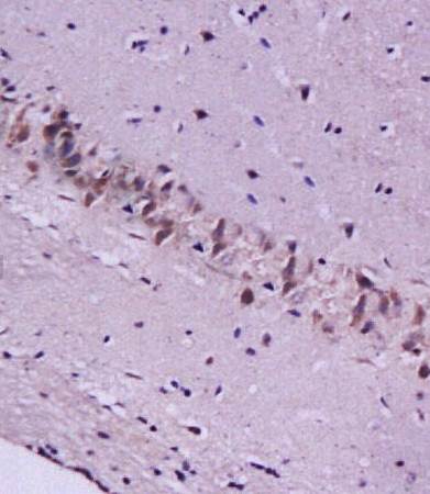 CYGB Rabbit Polyclonal Antibody