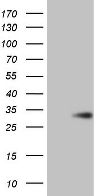 KRT18 Antibody