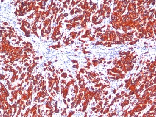 KRT77 Antibody