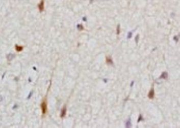 Cytokeratin 2 Rabbit Polyclonal Antibody