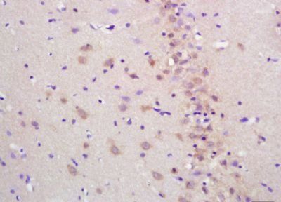 Cytosine deaminase Rabbit Polyclonal Antibody