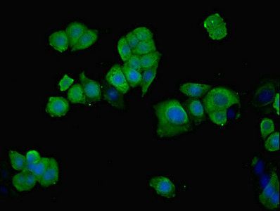 PHGDH Antibody