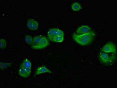 PHGDH Antibody