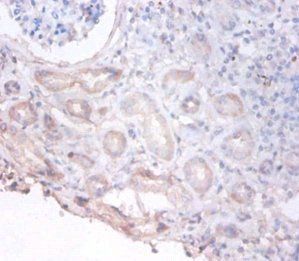 PHGDH Antibody