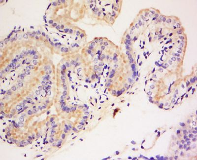 DAGLB Rabbit Polyclonal Antibody
