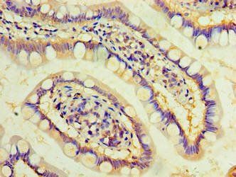 DAND5 Antibody