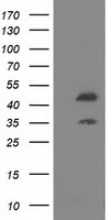 DAPK2 Antibody