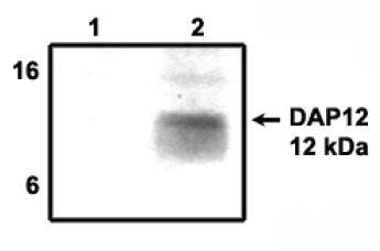 Rabbit anti Human DAP12 Antibody