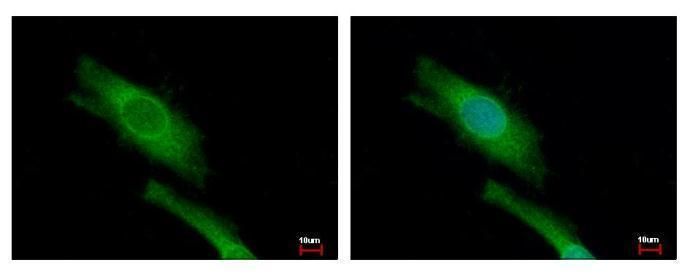 DAP5 Rabbit Polyclonal Antibody