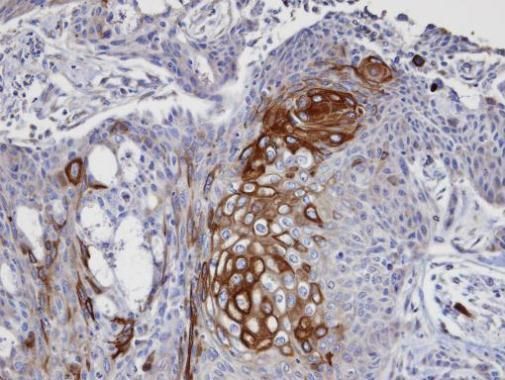 DAP5 Rabbit Polyclonal Antibody