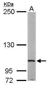 DAP5 Rabbit Polyclonal Antibody
